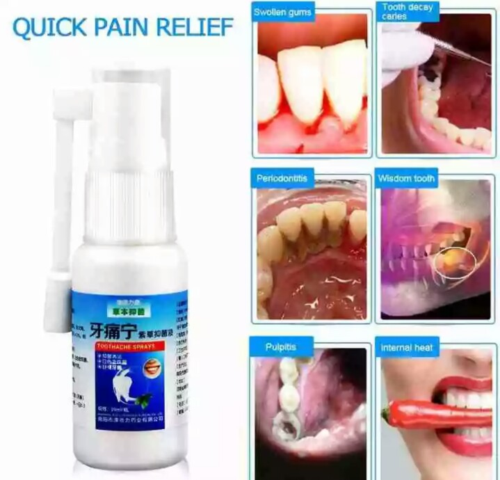 TOOTHACHE PAIN RELIEF SPRAY – Onlinemarket